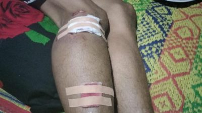 Niat Cari Rotan, Warga OKU Diserang Beruang